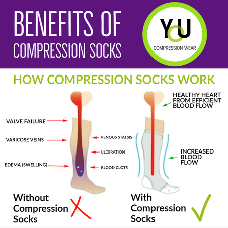 What Are Compression Socks? Types, Benefits, More